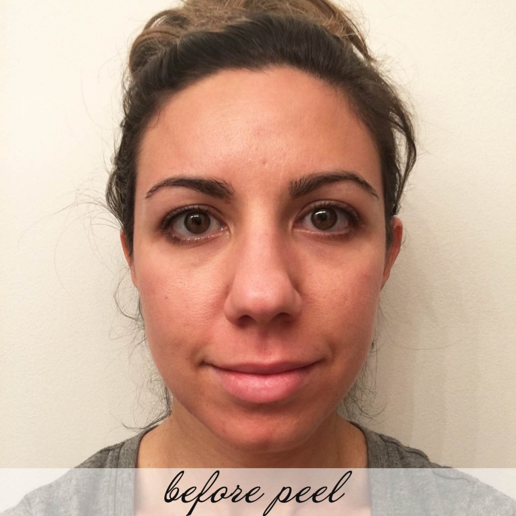Lifestyle Blogger Glass of Glam's review of the Serious Skincare Facial Peel and Gommage